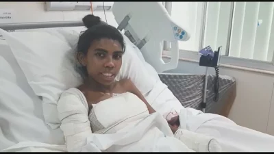 Mulher ferida em acidente é vista em leito hospitalar com bandagens no braço e no corpo. (Foto: g1.globo.com)