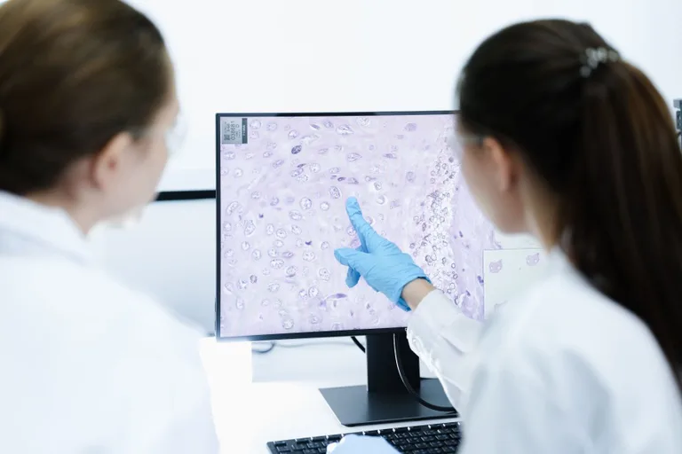 Nova aprovação da Anvisa fortalece tratamento contra linfoma